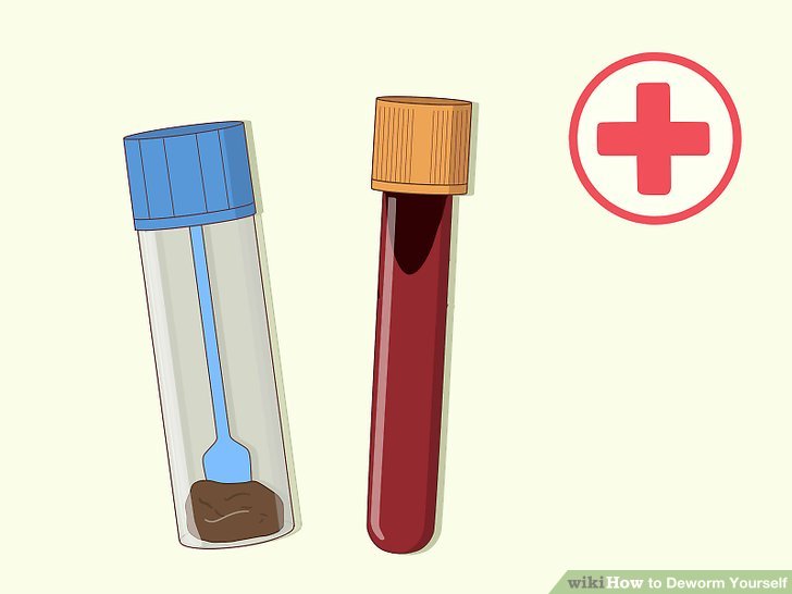 8 Ways to Deworm Yourself - wikiHow 8 Ways to Deworm Yourself - wikiHow